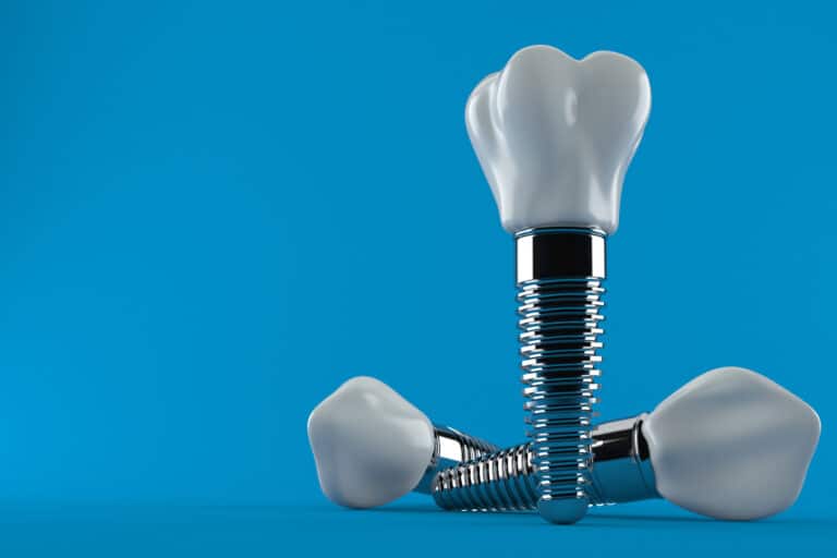 Implantes dentales en Zaragoza