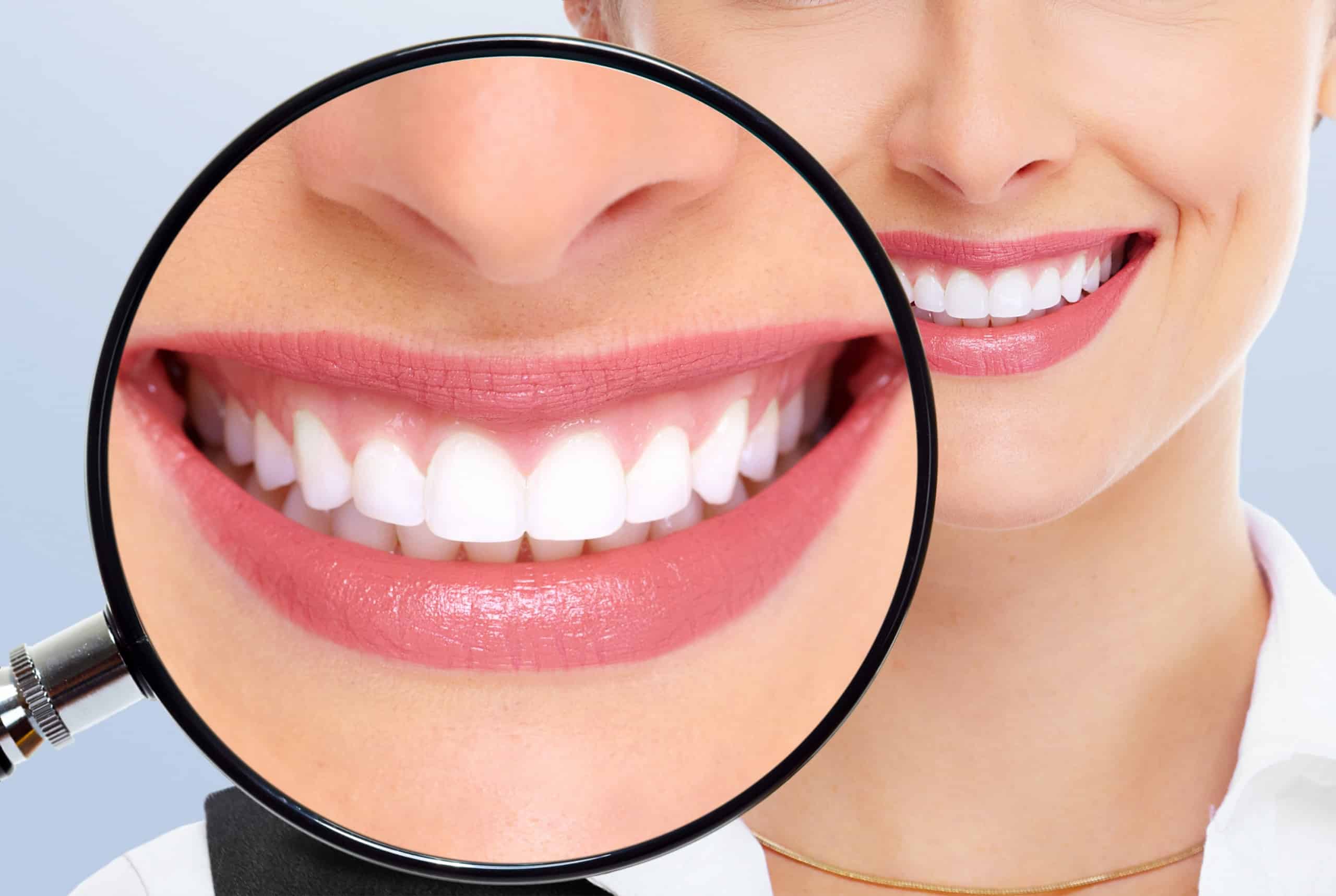 Blanqueamiento dental en Zaragoza