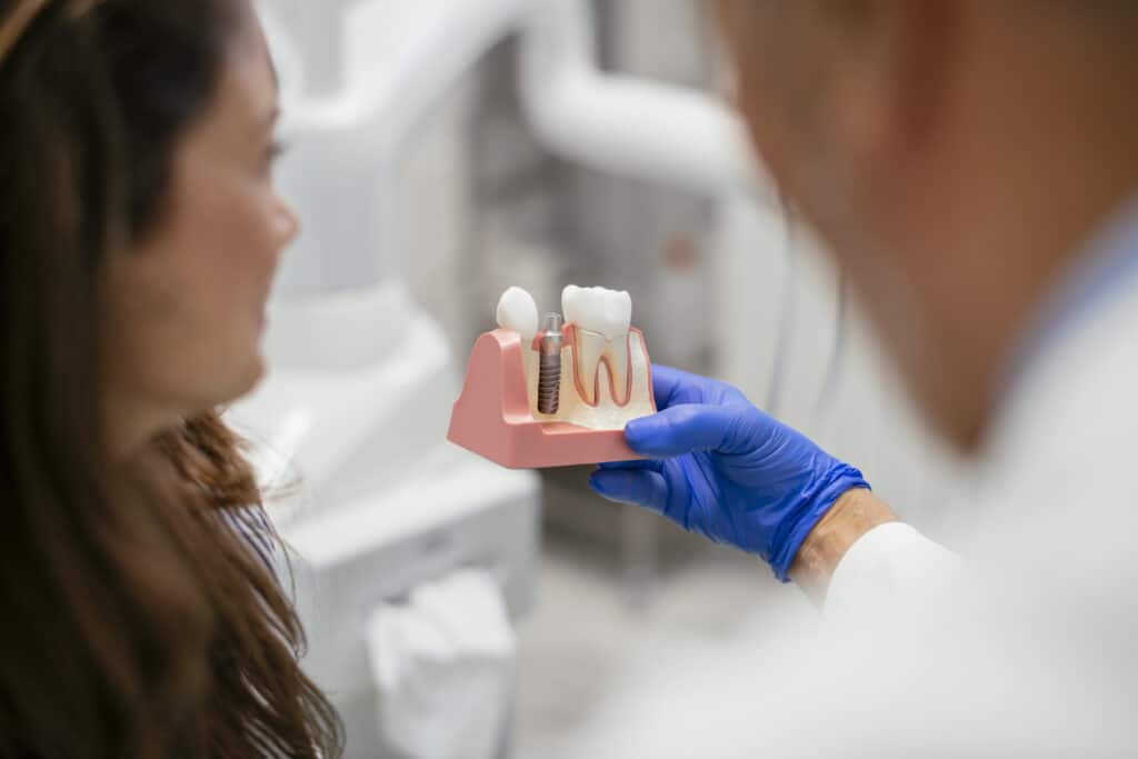 implantes dentales