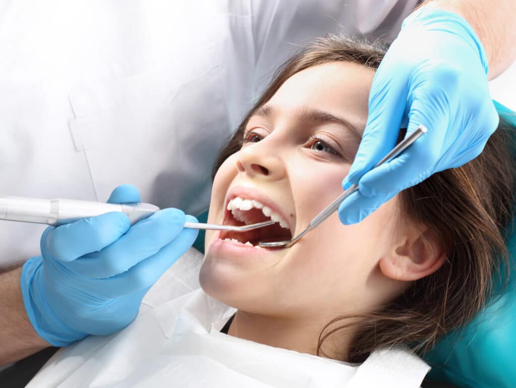 selladores dentales