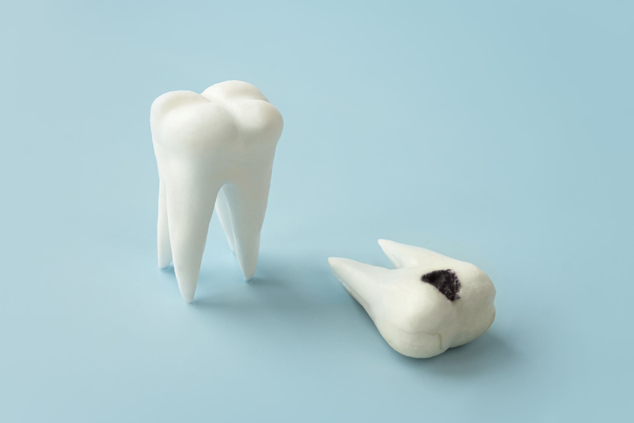 caries profundas