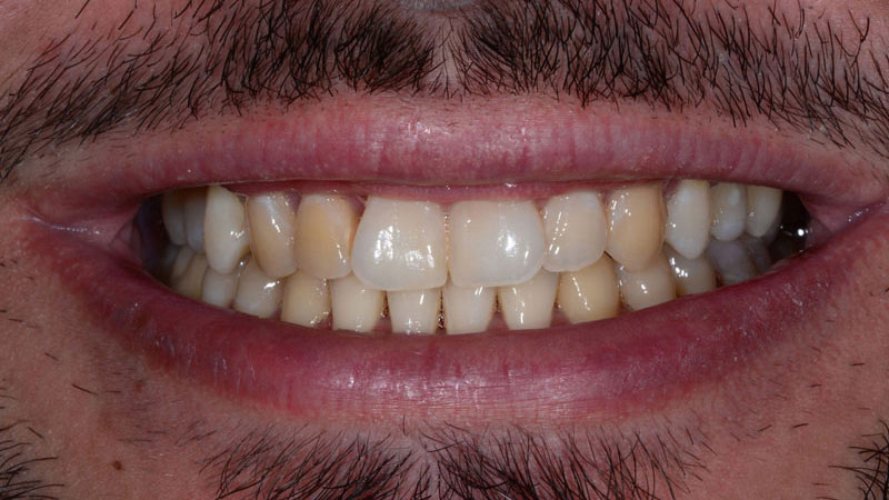 roger-dental-02-antes