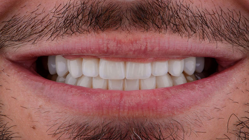 roger-dental-02-despues
