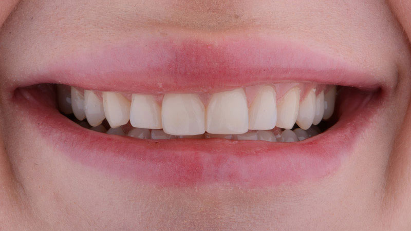 rogerdental-01-antes