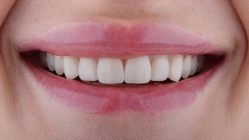 rogerdental-01-despues