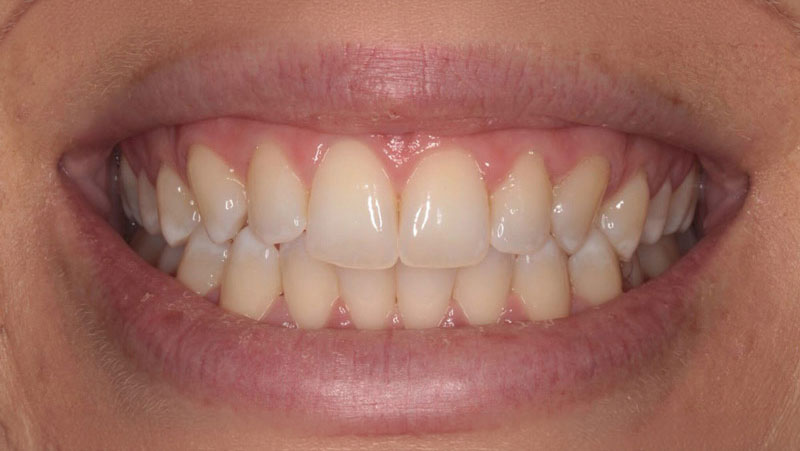 rogerdental-03-antes