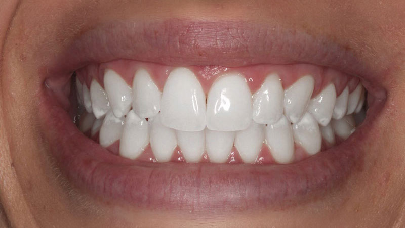 rogerdental-03-despues